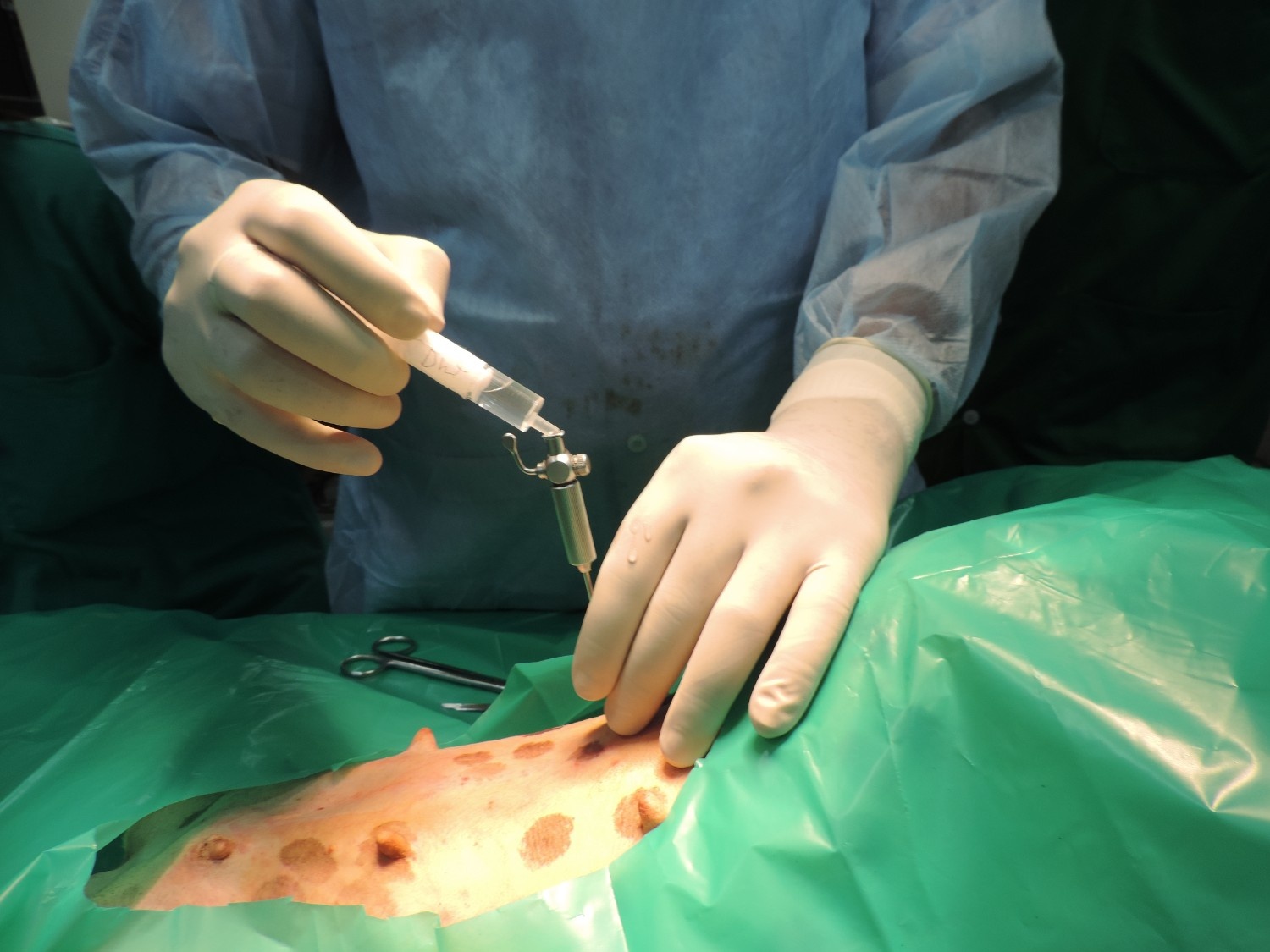 surgery-1